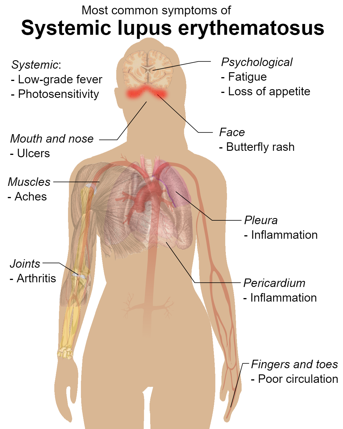 Communicable Diseases, Disease Prevention and the Immune System, figure 1