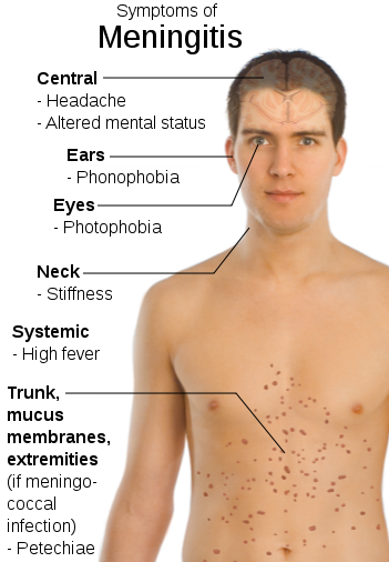 Communicable Diseases, Disease Prevention and the Immune System, figure 2